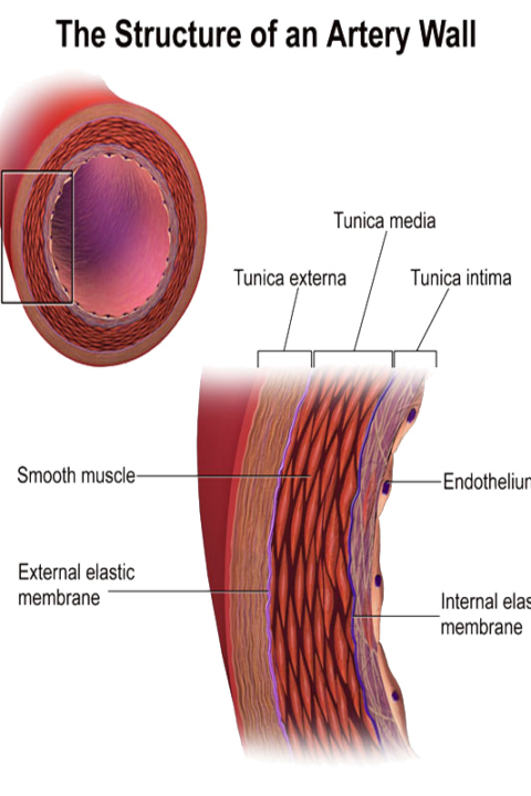 Peripheral Arterial Disease Treatments